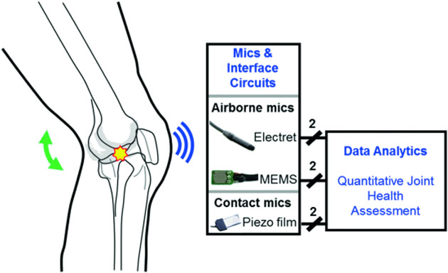 Block diagram of knee joint acoustic emissions sensing and interpretation for quantifying joint health during rehabilitation.
