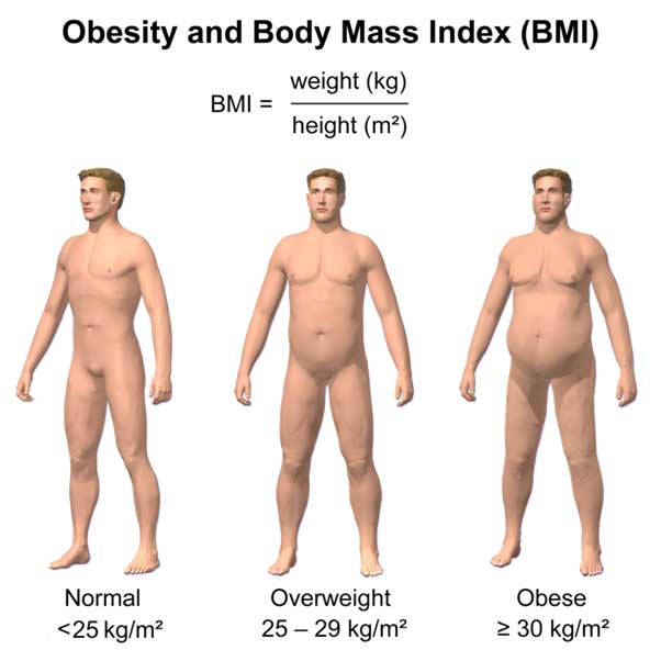 Obesity and BMI 