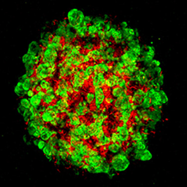 Developing human liver organoid tissue-engineered by scientists with human pluripotent stem cells (hPSCs). Green sections show forming hepatic tissues and red show developing blood vessels. Reporting their research results in Nature, scientists are developing the miniature organs for their potential to study and treat liver disease.