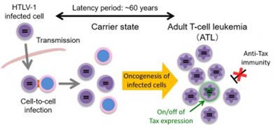 How HTLV-1 may infect a host and induce a case of ATL. (Source: Kyoto University/Jun-ichirou Yasunaga)