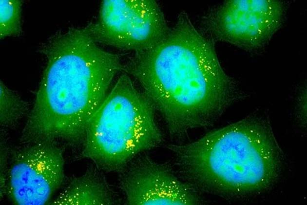 Image shows that the lung epithelial cells have incorporated the mRNA-carrying-nanoparticles (yellow). The fluorescent green represents the mRNA which has encoded for the luciferase protein. (Source: Asha Patel)