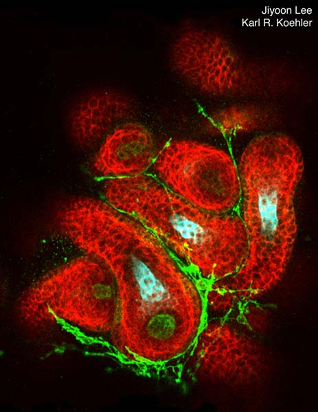 Lee et al. show that hair follicles can be generated from mouse pluripotent stem cells in a 3D cell culture system. The hair follicles (red) grow radially out of spherical skin organoids and contain follicle-initiating dermal papilla cells (green cells) and hair shafts (cyan). Artwork by Jiyoon Lee and Karl R. Koehler.