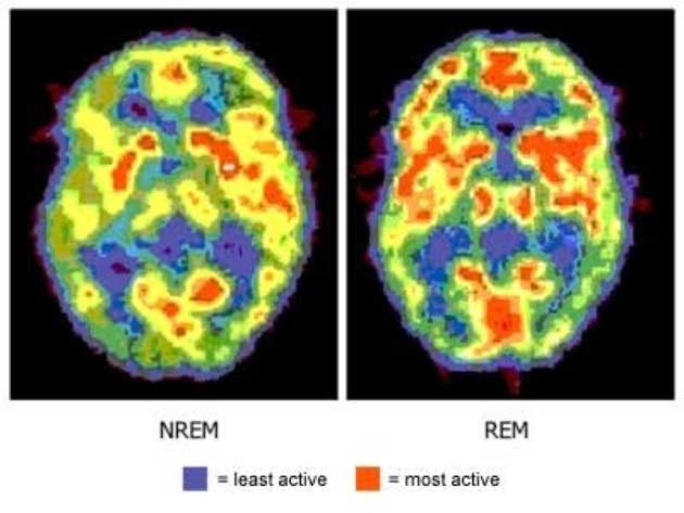 Image of the brain during the two different phases – NREM and REM – of sleep. (Source: Quora)