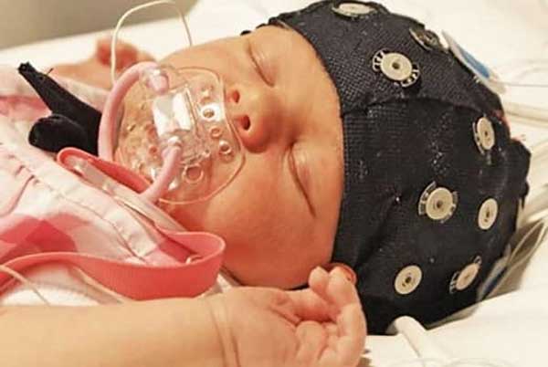 EEG monitoring combined with automatic analysis provides a practical tool for the monitoring of the neurological development of preterm infants and generates information which will help plan the best possible care for the individual child. Credit: University of Helsinki