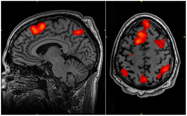Image of the brain during memory tasks. (Source: John Graner/Wikipedia)