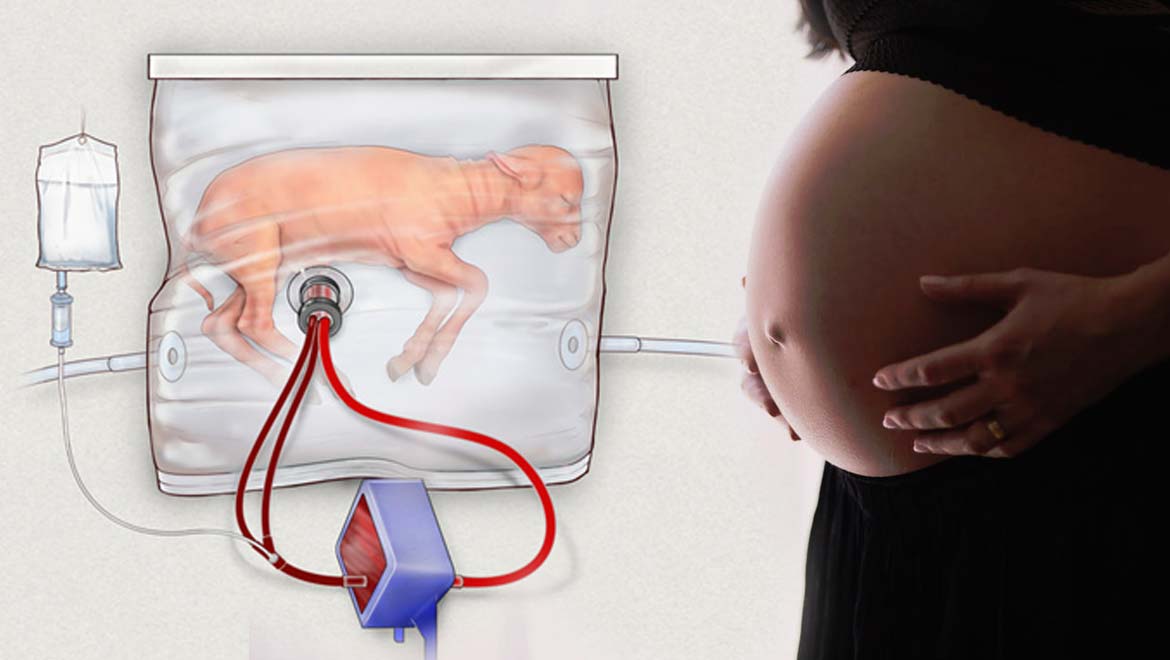 [Left] An illustration of a fetal lamb inside the 