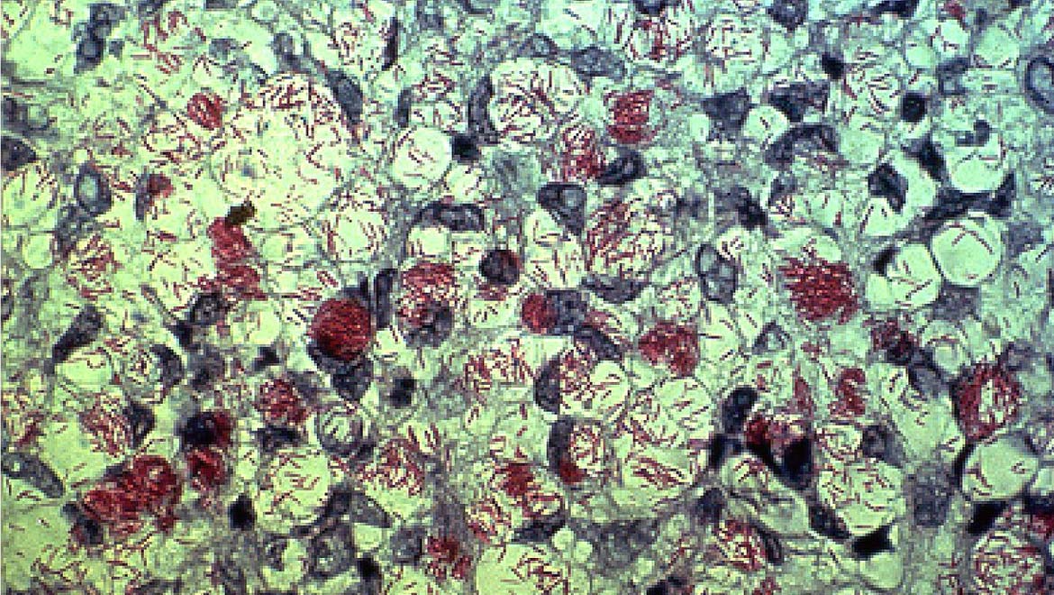 Investigating Drug-Resistant Strains of Leprosy Bacteria