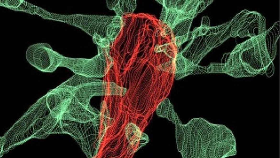 Microglia, the Gardeners of the Brain: New Imaging Techniques Confirms Neurodevelopmental Theory