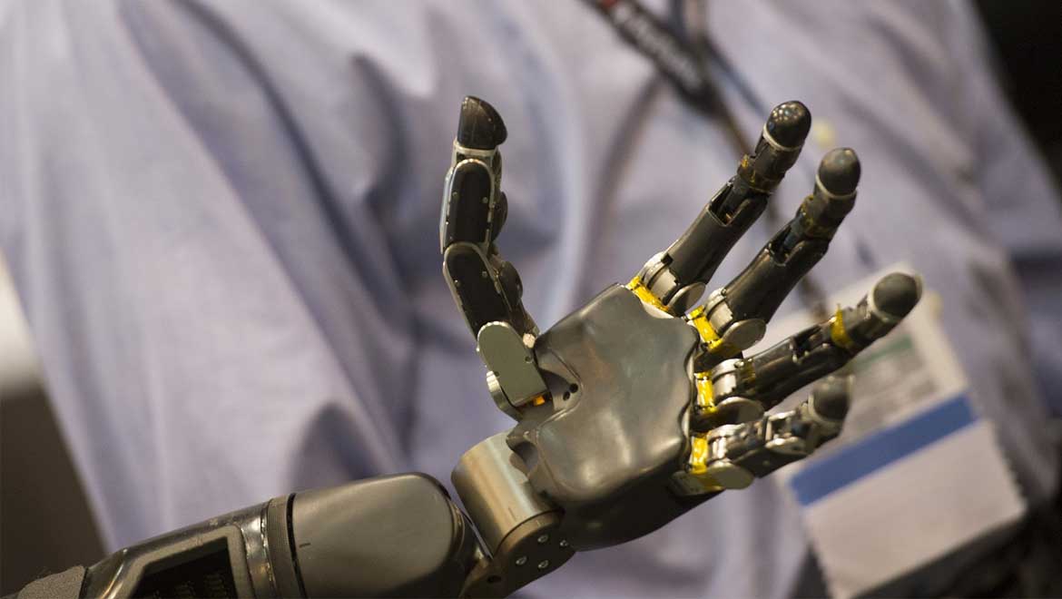 New Prosthetics For Amputees Controlled Only By Nerve Signals