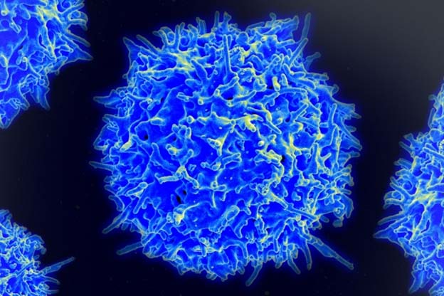 A scanning electron micrograph of a human T lymphocyte (also called a T-cell) from the immune system of a healthy donor. Researchers have designed a synthetic gene circuit that triggers the immune system to attack cancers when it detects signs of the disease. Image: NIAID (edited by MIT News)