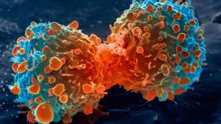 A dividing lung cancer cell. Credit: National Institutes of Health