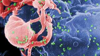 A Step Closer Towards Curing HIV in Those Born With The Disease 