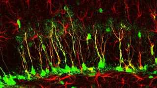 Do Adults Grow New Brain Cells? A Scientific Debate Rages On…