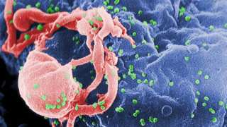 These Super-Antibodies Can Attack Almost All HIV Strains