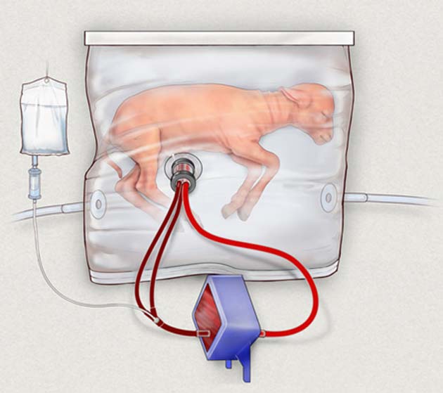 An illustration of a fetal lamb inside the "artificial womb" device, which mimics the conditions inside a pregnant animal.